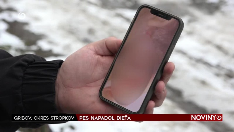 PES NAPADOL DIEŤA