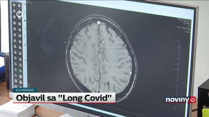 Objavil sa "Long Covid"