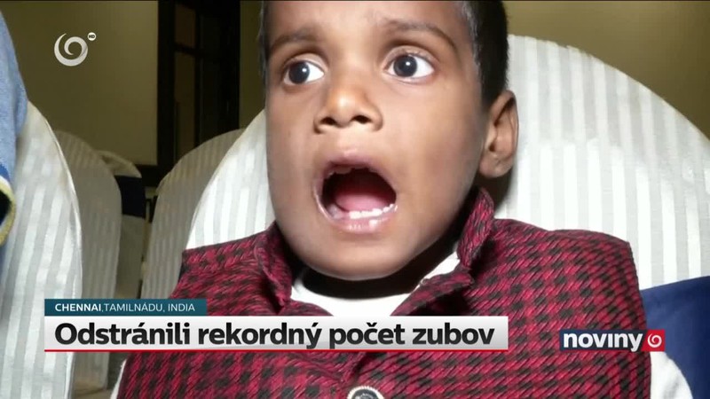 Odstránili rekordný počet zubov