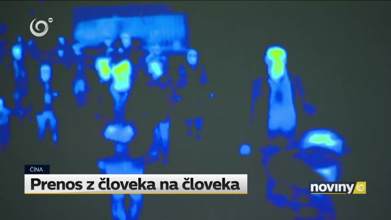 Prenos z človeka na človeka