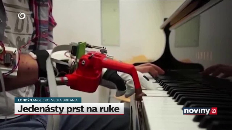 Jedenásty prst na ruke