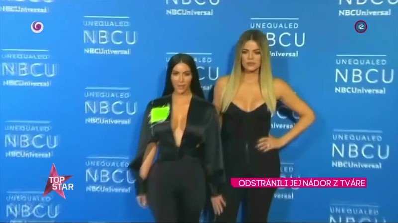 ODSTRÁNILI JEJ NÁDOR Z TVÁRE