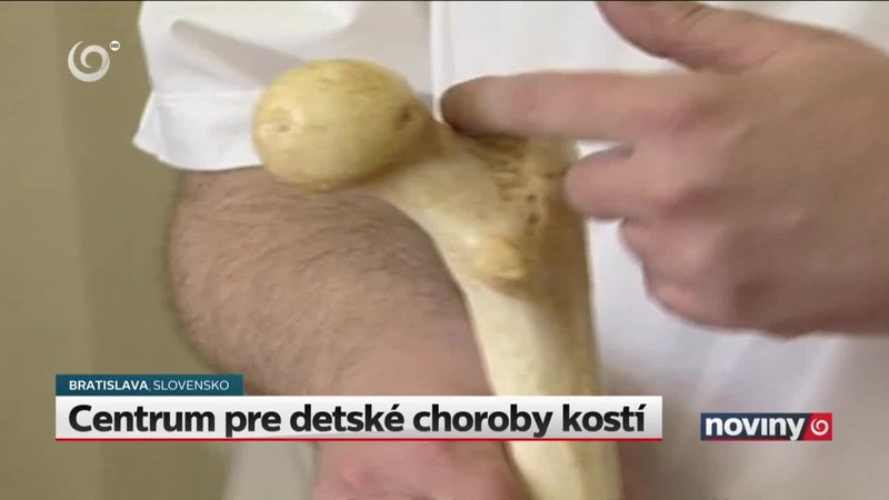 Centrum pre detské choroby kostí