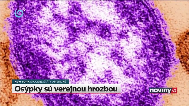 Osýpky sú verejnou hrozbou