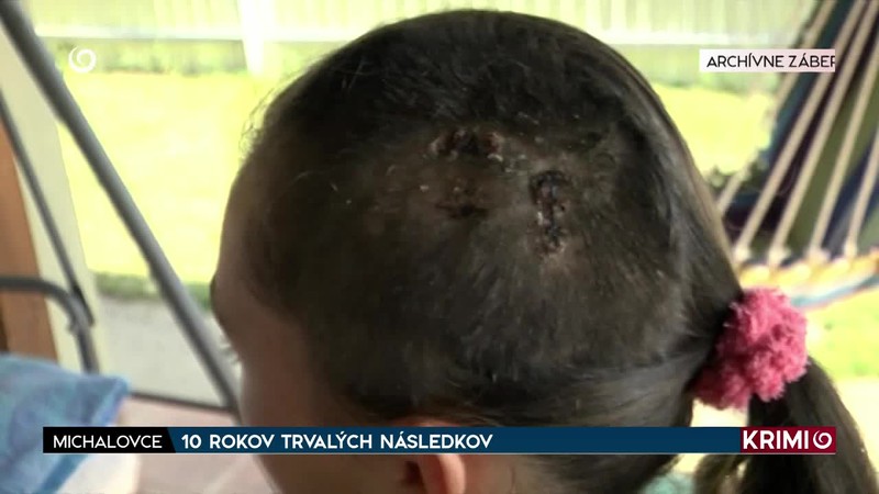 10 ROKOV TRVALÝCH NÁSLEDKOV