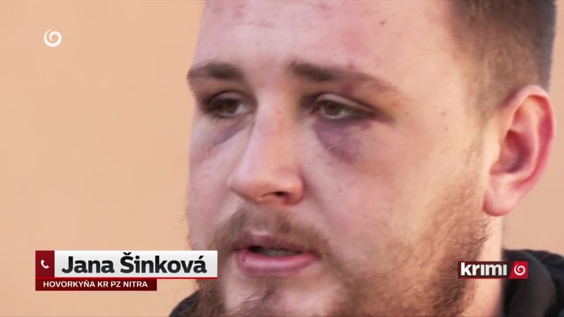 Mladíka brutálne zbili susedia