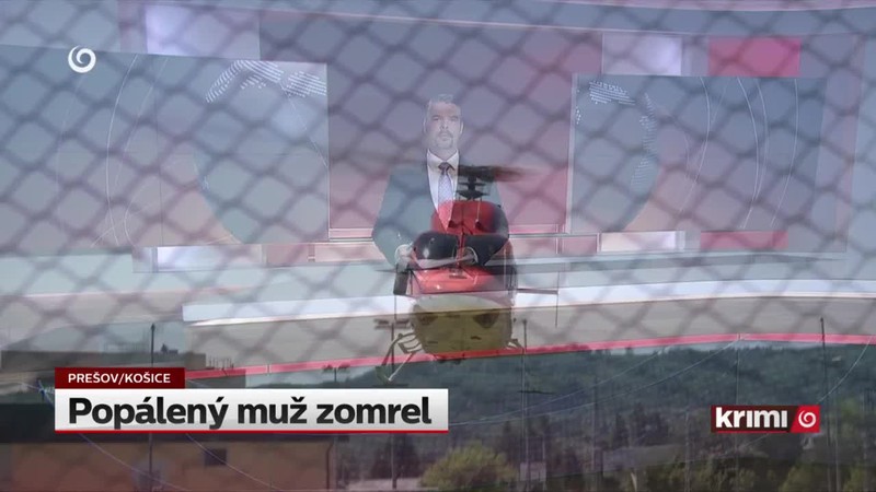 Popálený muž zomrel