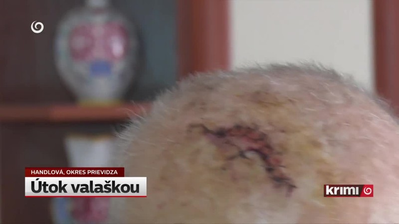 Útok valaškou