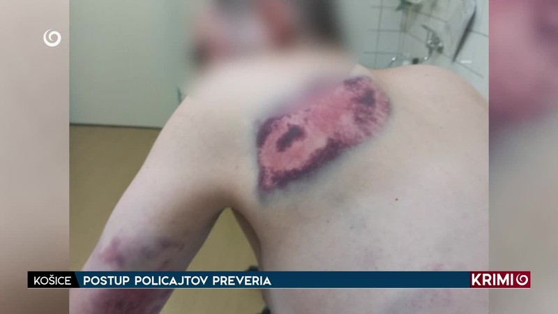 POSTUP POLICAJTOV PREVERI