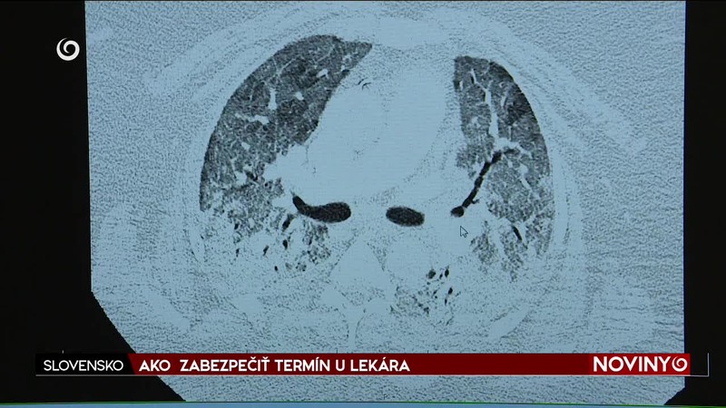AKO  ZABEZPEČIŤ TERMÍN U LEKÁRA