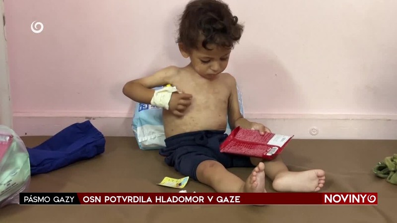 OSN POTVRDILA HLADOMOR V GAZE