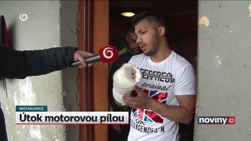 Útok motorovou pílou