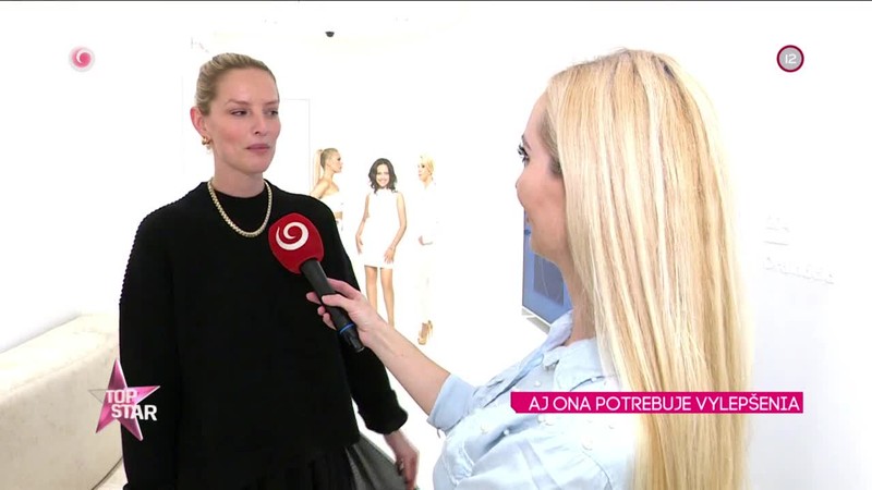 AJ ONA POTREBUJE VYLEPŠENIA