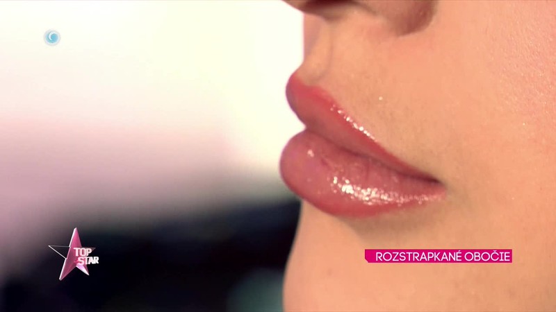 Rozstrapkané obočie