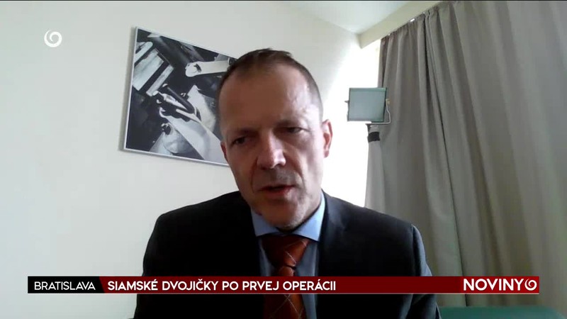 SIAMSKÉ DVOJIČKY PO PRVEJ OPERÁCII