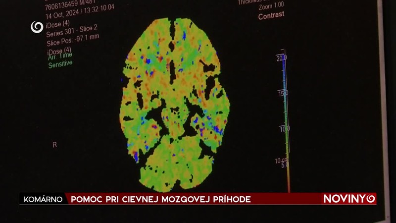 POMOC PRI CIEVNEJ MOZGOVEJ PRÍHODE