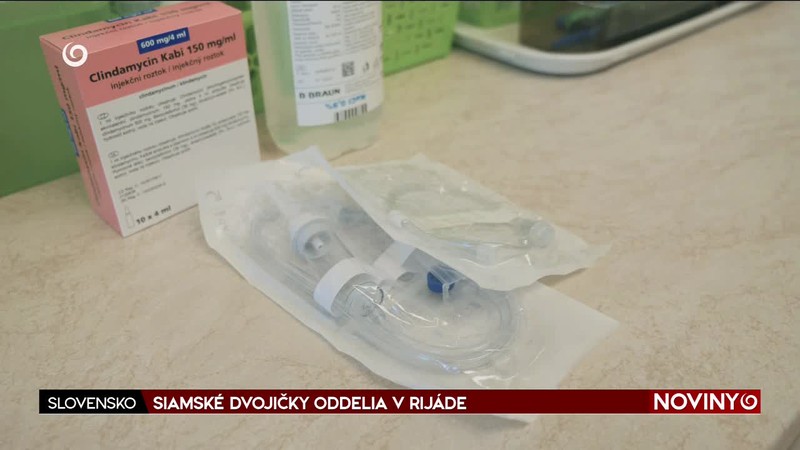 SIAMSKÉ DVOJIČKY ODDELIA V RIJÁDE