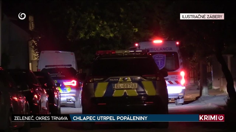 CHLAPEC UTRPEL POPÁLENINY