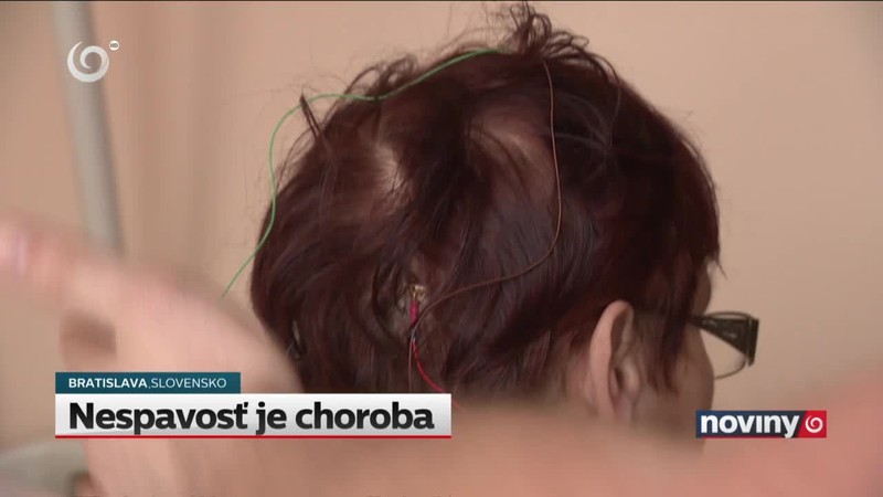 Nespavosť je choroba