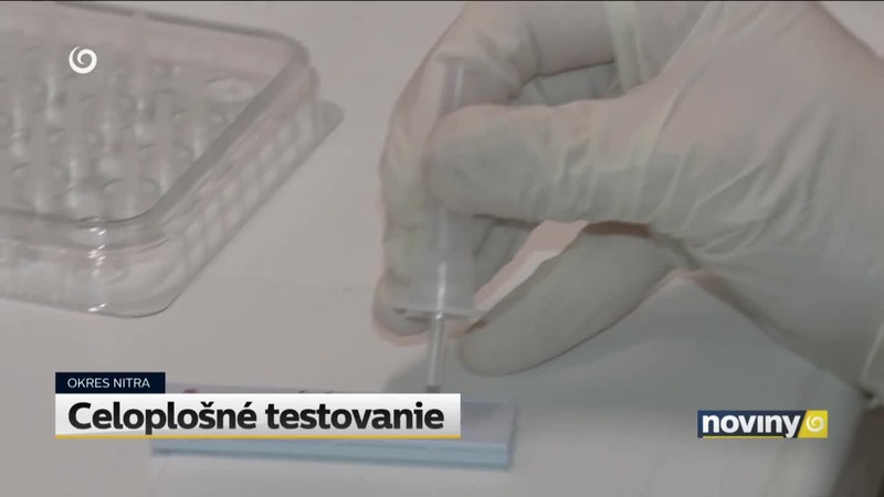 Celoplošné testovanie