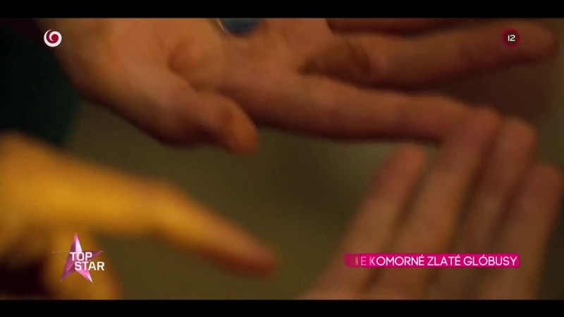 NEZVYČAJNE KOMORNÉ ZLATÉ GLÓBUSY