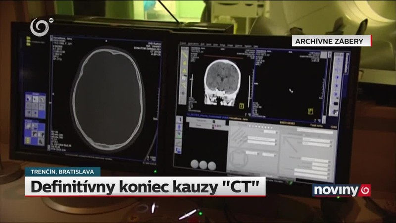 Definitívny koniec kauzy "CT"