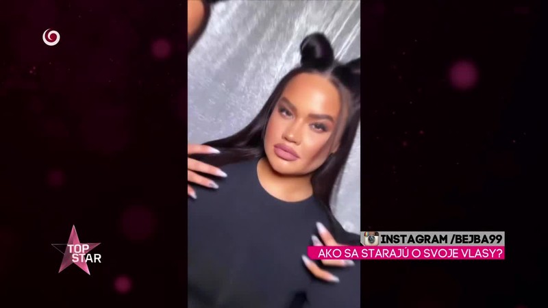 AKO SA STARAJÚ O SVOJE VLASY?