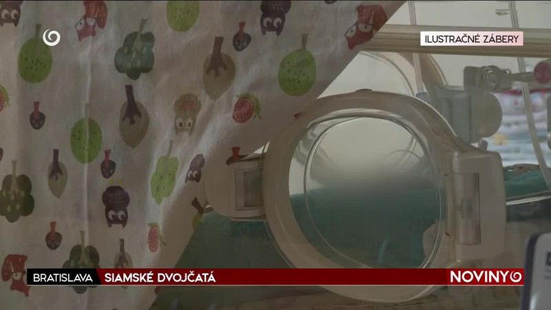 SIAMSKÉ DVOJČATÁ