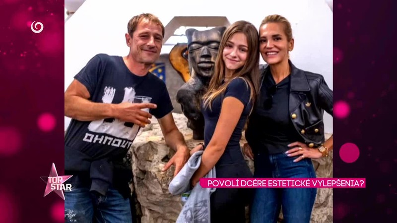 POVOLÍ DCÉRE ESTETICKÉ VYLEPŠENIA?