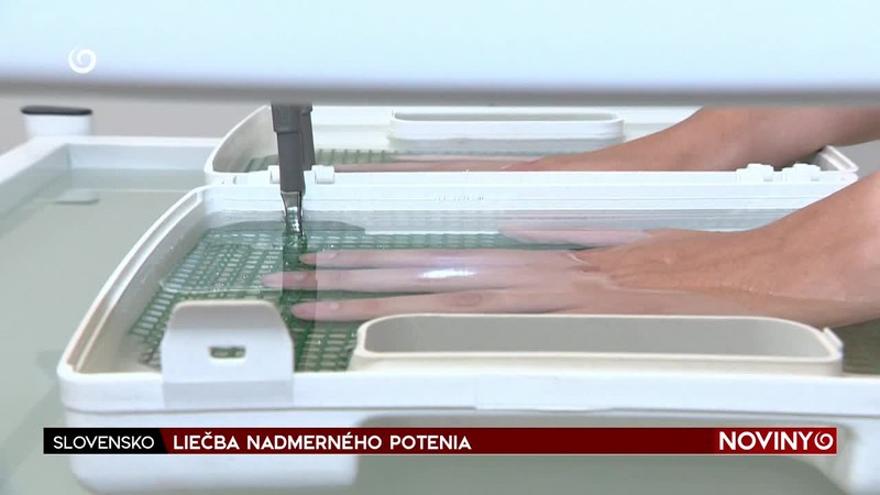 LIEČBA NADMERNÉHO POTENIA