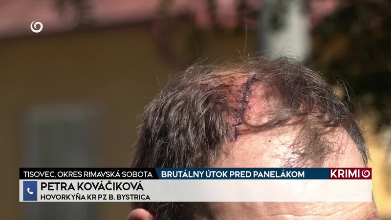BRUTÁLNY ÚTOK PRED PANELÁKOM
