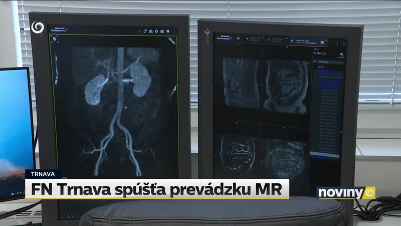 FN Trnava spúšťa prevádzku MR