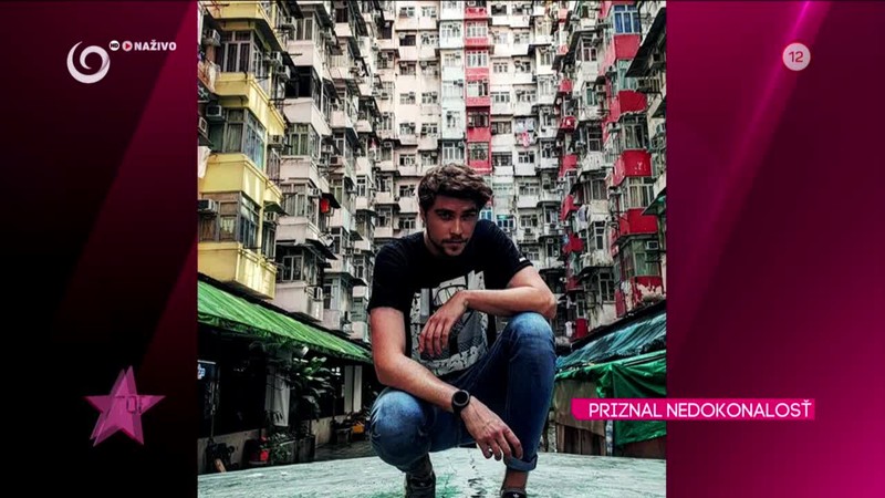 PRIZNAL NEDOKONALOSŤ