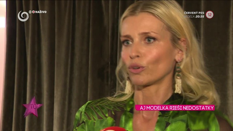 AJ MODELKA RIEŠI NEDOSTATKY Pestova