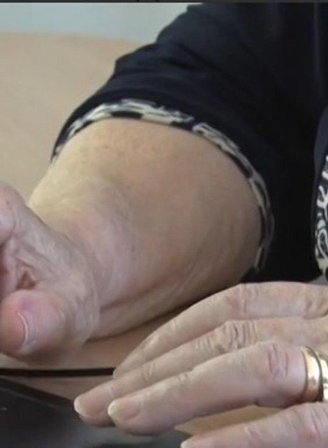 senior linka potrebuje pomoc