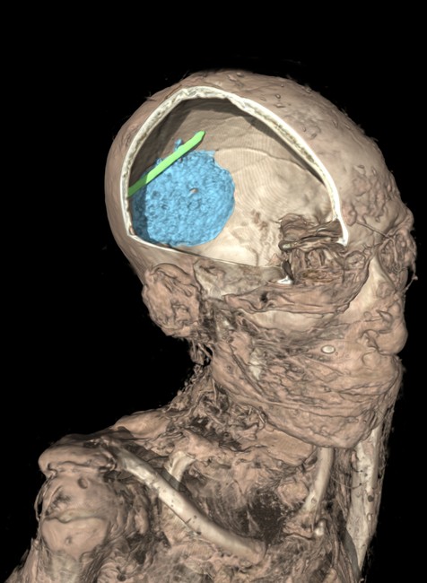 Múmie v britskom múzeu