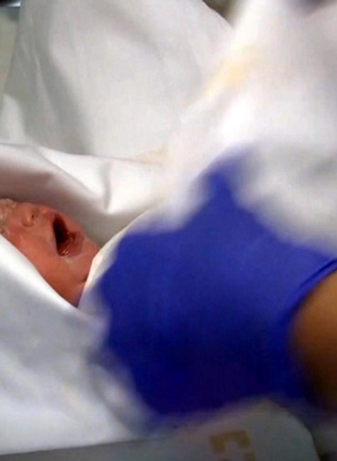 Eliška, ktorá sa narodila mamičke s mozgovou smrťou