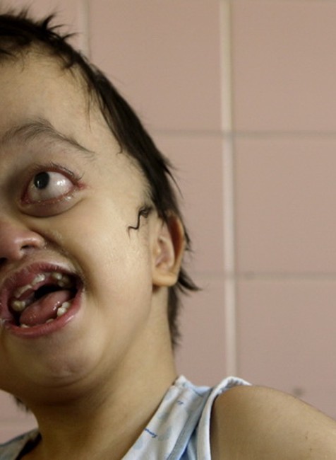 Agent Orange vietnamec 0