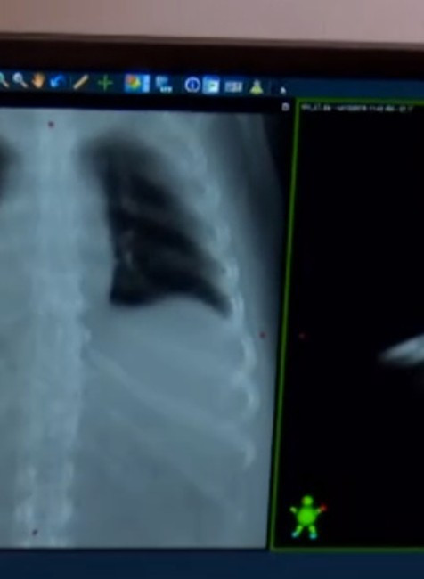 Technologická novinka v nemocnici v Komárne je skokom do budúcnosti