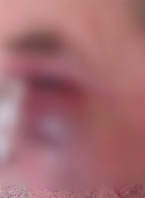 Poľovníka brutálne dobili.