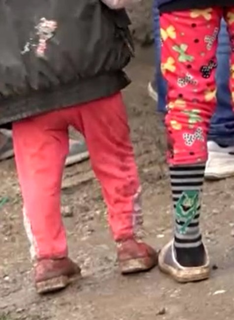 Dievčatko zrazilo cúvajúce auto.