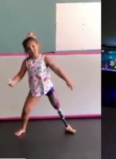 Malá tanečnica s protézou