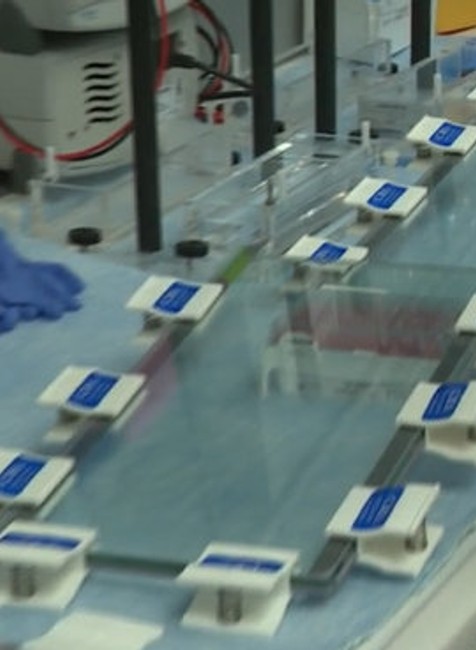 Inovatívna liečba rakoviny dostupná už aj na Slovensku. 