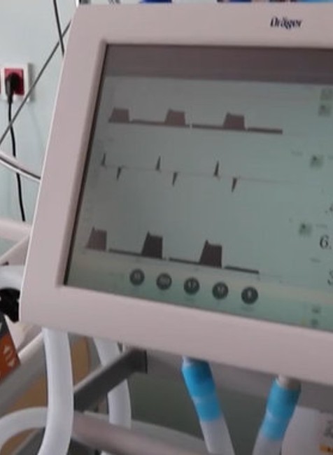 Náročná starostlivosť o pacientov.