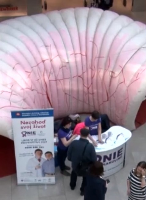 Masívna kampaň bojuje proti rakovine hrubého čreva. Viete ako sa otestovať?