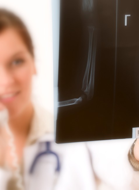 lekarka rontgen telefonuje rozmazana