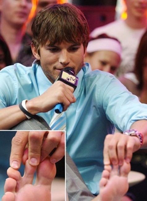 Fešák Ashton Kutcher ma dva zrastené prsty na nohe