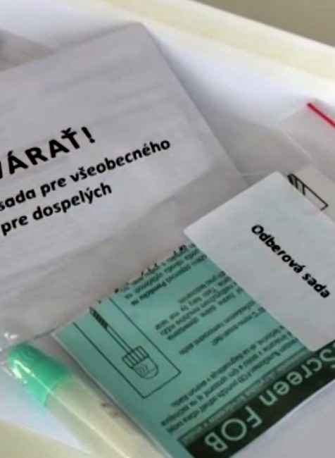 Za preventívnu prehliadku sľubujú poisťovne odmeny. Od apríla sa zamerajú na ženy