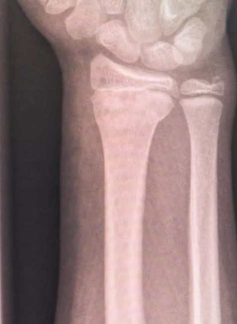 Naučme deti nebáť sa nemocníc. V Národnom ústave detských chorôb bojujú proti strachu