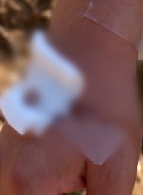 dobodaný muž sršňami 